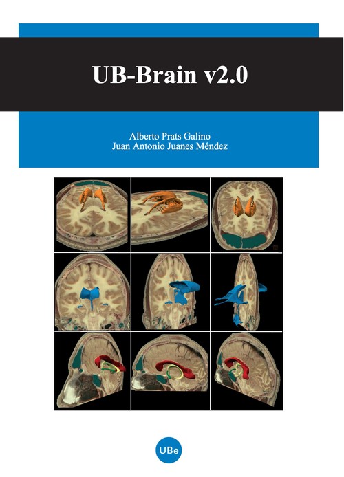 UB-BRAIN V2,0 (LLIBRE+CD-ROM)