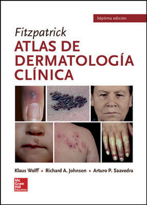 BL FITZPATRICK ATLAS DE DERMATOLOGIA CLINICA