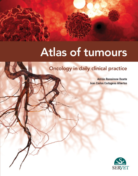 ATLAS OF TUMOURS, ONCOLOGY IN DAILY CLINICAL PRACTICE