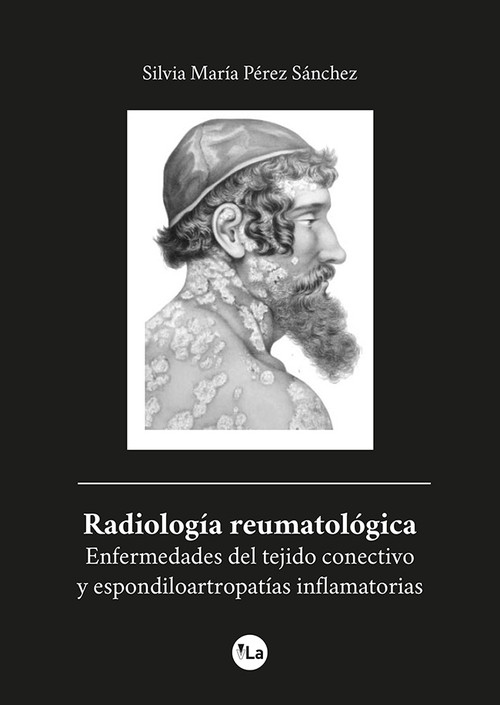 RADIOLOGIA REUMATOLOGICA