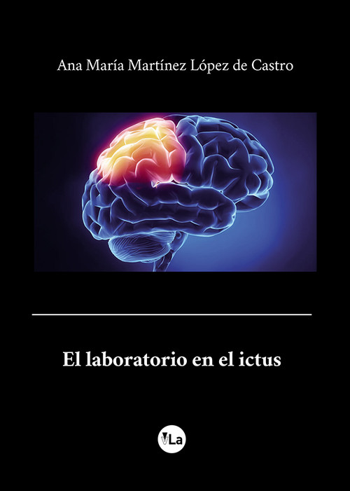 LABORATORIO EN EL ICTUS,EL