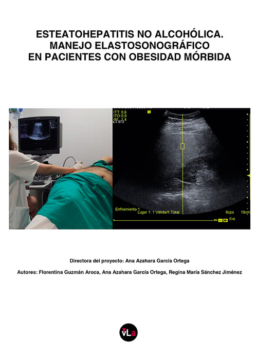 ESTEATOHEPATITIS NO ALCOHOLICA,