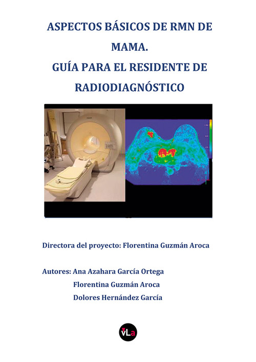 ASPECTOS BASICOS DE RMN DE MAMA,