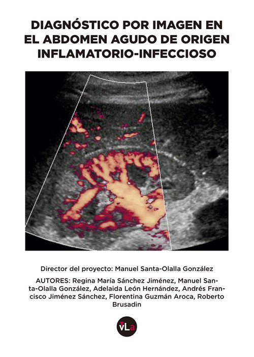 DIAGNOSTICO POR IMAGEN EN EL ABDOMEN AGUDO DE ORIGEN INFLAMA
