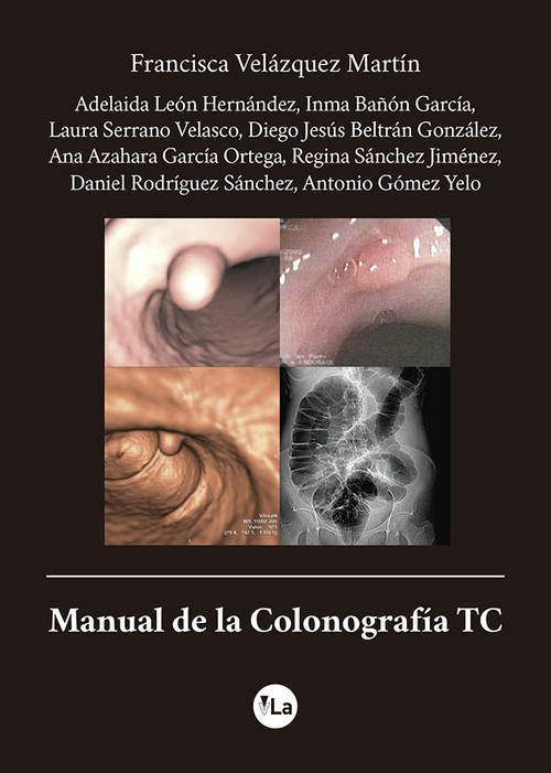 MANUAL DE LA COLONOGRAFIA TC