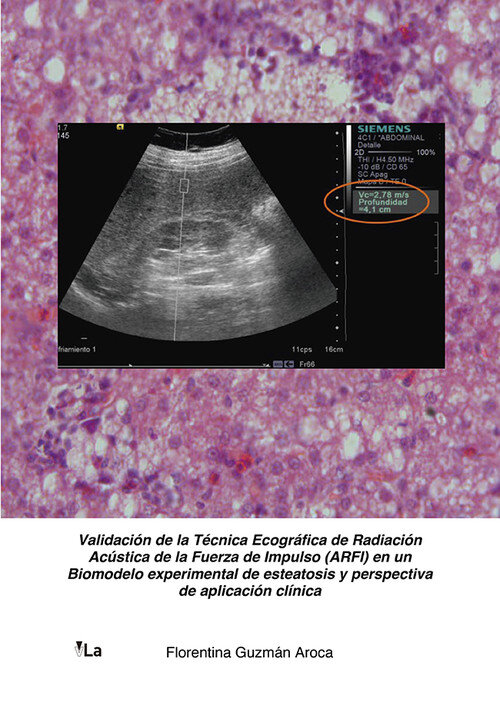 VALIDACION DE LA TECNICA ECOGRAFICA DE RADIACION ACUSTICA DE