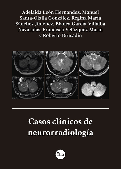 CASOS CLINICOS DE NEURORRADIOLOGIA