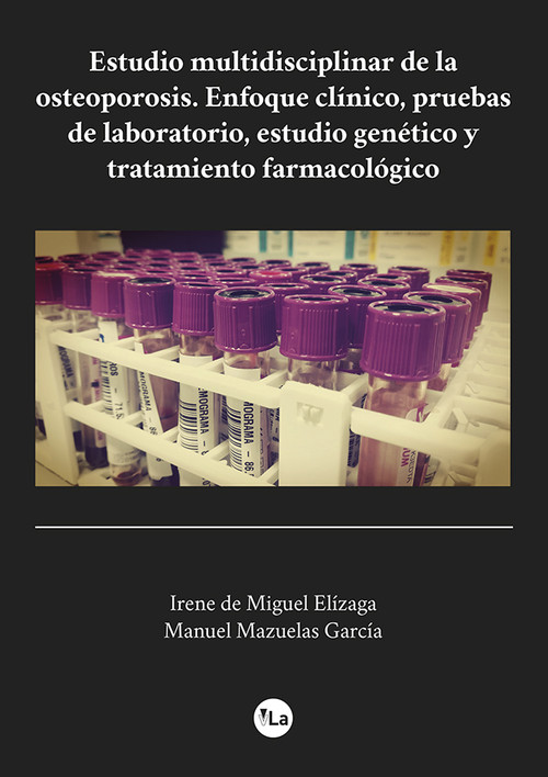 ESTUDIO MULTIDISCIPLINAR DE LA OSTEOPOROSIS