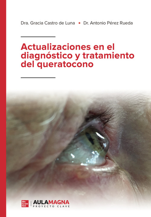 ACTUALIZACIONES EN EL DIAGNOSTICO Y TRATAMIENTO DEL QUERATOC