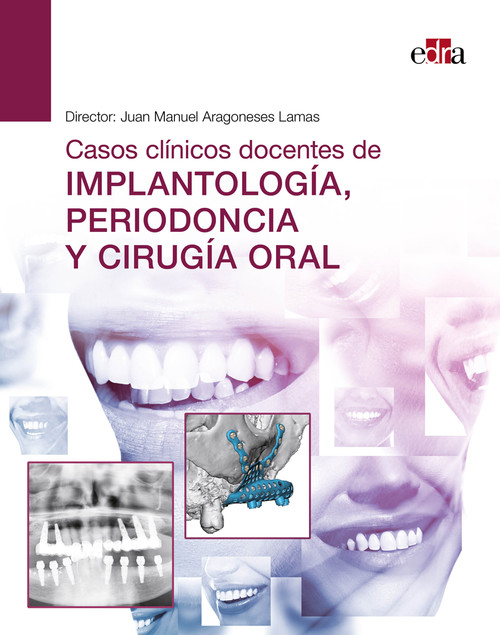 CASOS CLINICOS DOCENTES DE IMPLANTOLOGIA PERIODONCIA Y CIRUG