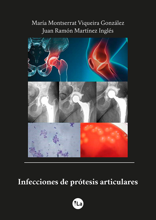 INFECCIONES DE PROTESIS ARTICULARES