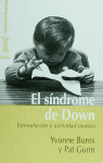 SINDROME DE DOWN, EL