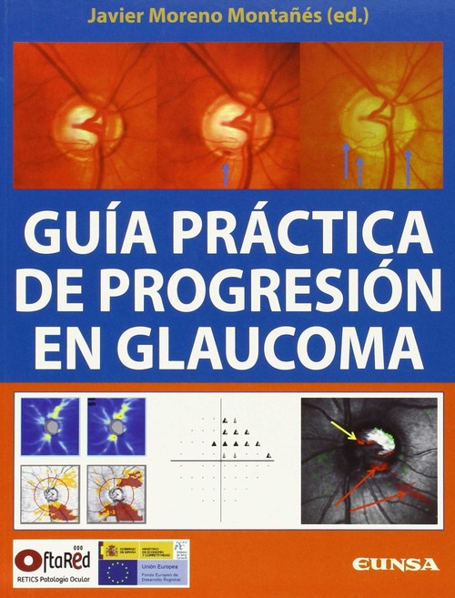GUIA PRACTICA DE PROGRESION EN GLAUCOMA