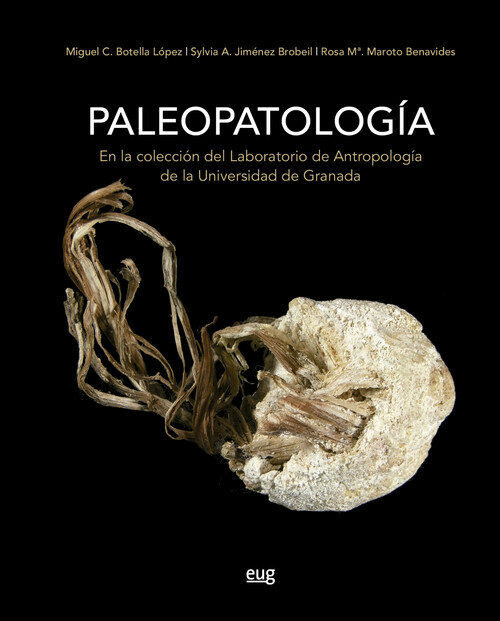 PALEOPATOLOGIA EN LA COLECCION DEL LABORATORIO DE ANTROPOLOG