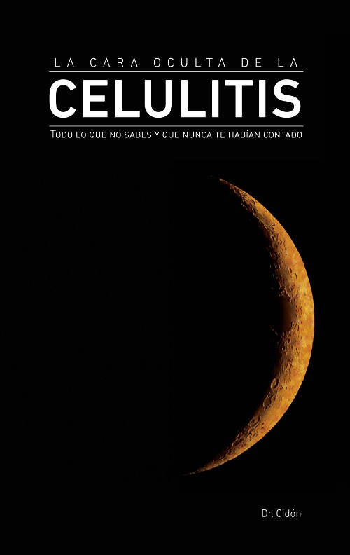 CARA OCULTA DE LA CELULITIS,LA