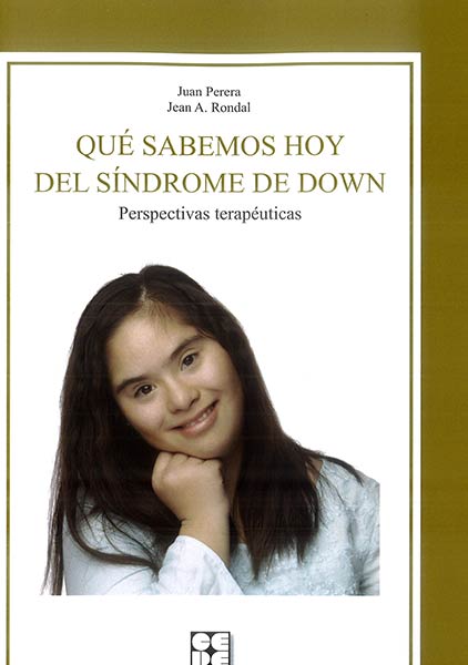 QUE SABEMOS HOY DEL SINDROME DE DOWN