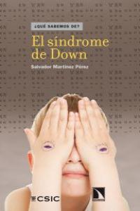 SINDROME DE DOWN, EL