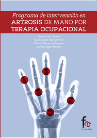 TERAPIA OCUPACIONAL EN SINDROME DE DOWN Y DEMENCIA