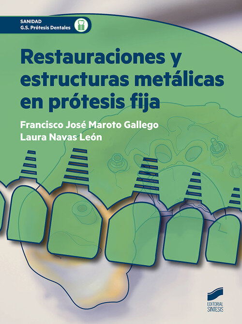 RESTAURACIONES Y ESTRUCTURAS METALICAS EN PROTESIS FIJA
