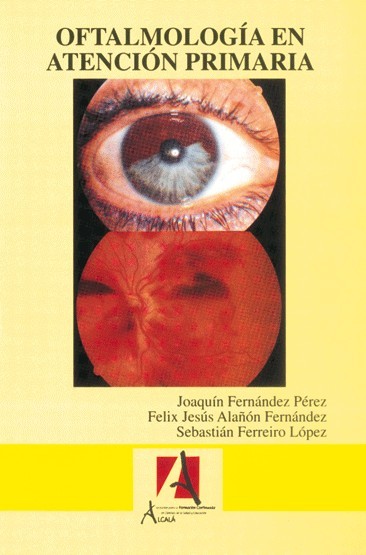 OFTALMOLOGIA EN ATENCION PRIMARIA