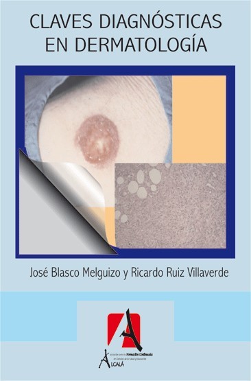 CLAVES DIAGNOSTICAS EN DERMATOLOGIA