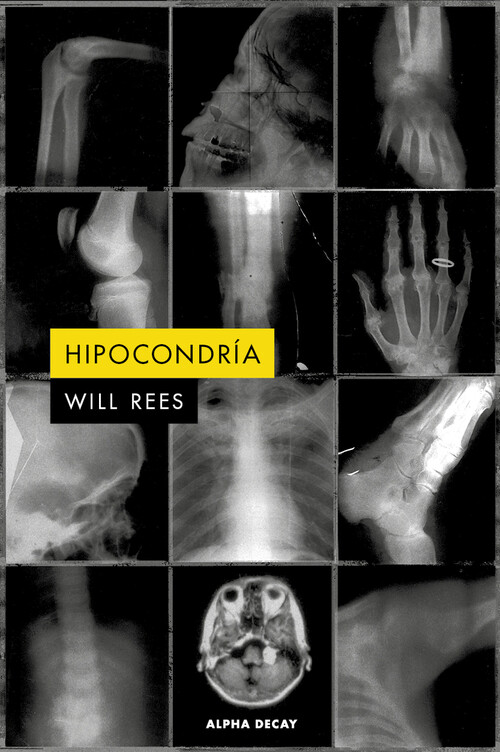 ANTIBODY MOLECULE OMH